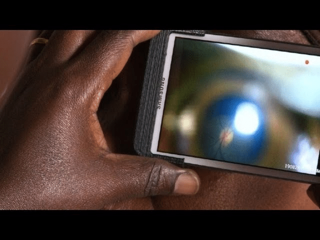 ¡Visión Perfecta con Examen Gratis!