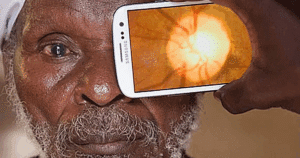 Visión Perfecta Gratis