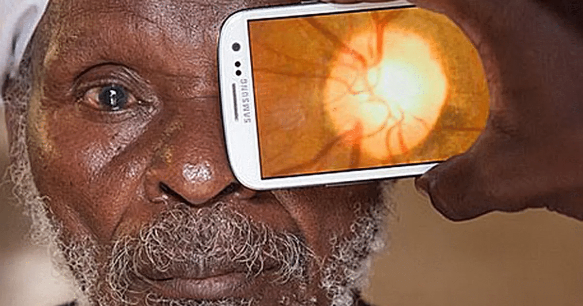 Visión Perfecta Gratis